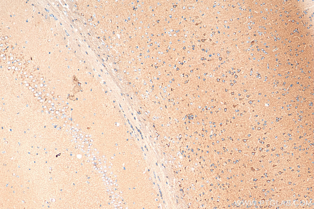 Immunohistochemistry (IHC) staining of mouse brain tissue using SLITRK1 Polyclonal antibody (21119-1-AP)