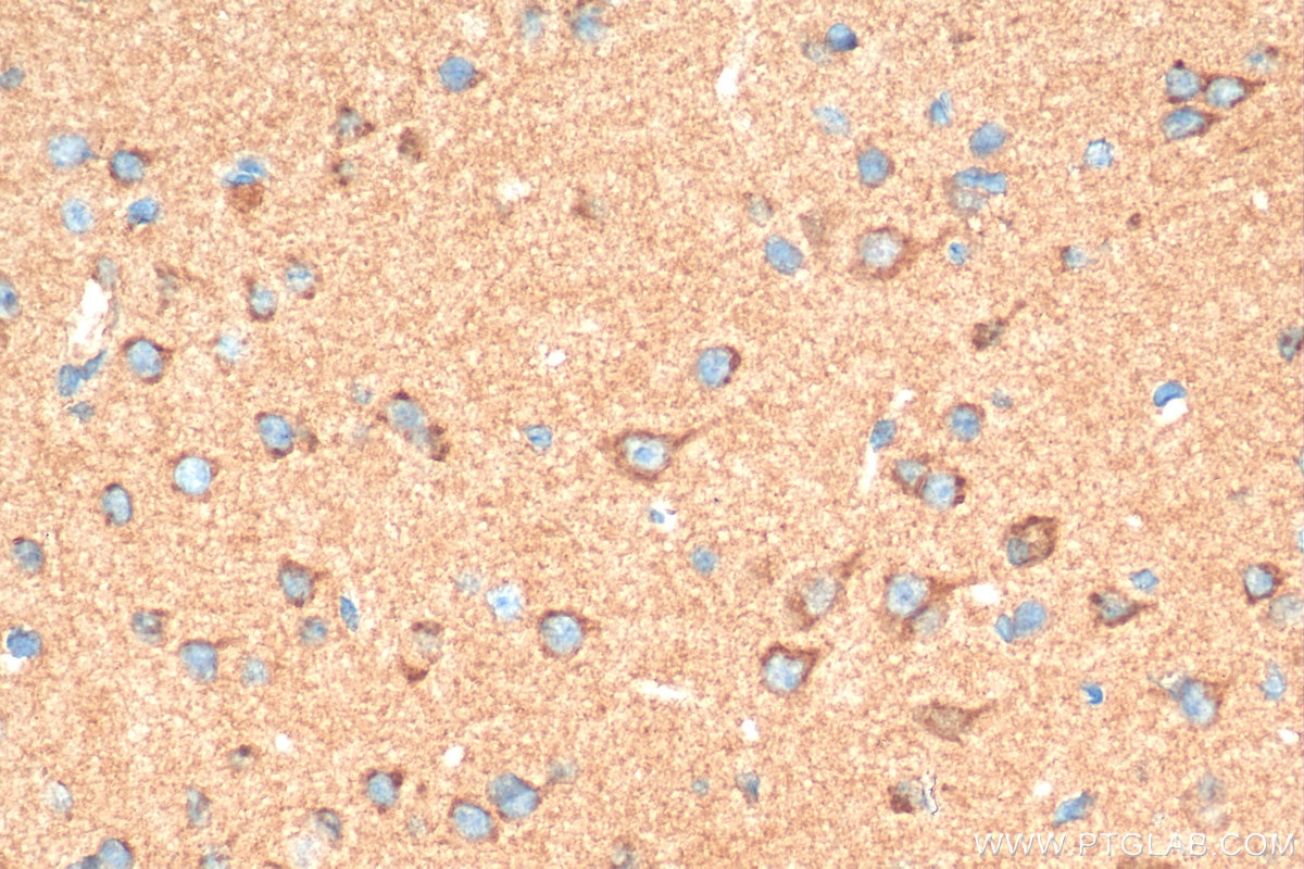 Immunohistochemistry (IHC) staining of mouse brain tissue using SLITRK1 Polyclonal antibody (21119-1-AP)