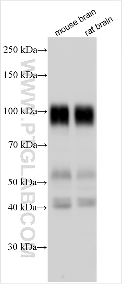 Western Blot (WB) analysis of various lysates using SLITRK1 Polyclonal antibody (21119-1-AP)