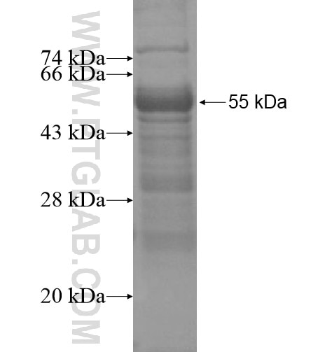 SLITRK1 fusion protein Ag15461 SDS-PAGE