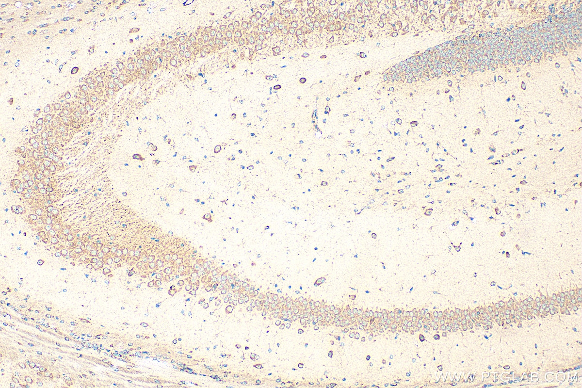 Immunohistochemistry (IHC) staining of mouse brain tissue using SLITRK2 Polyclonal antibody (21508-1-AP)