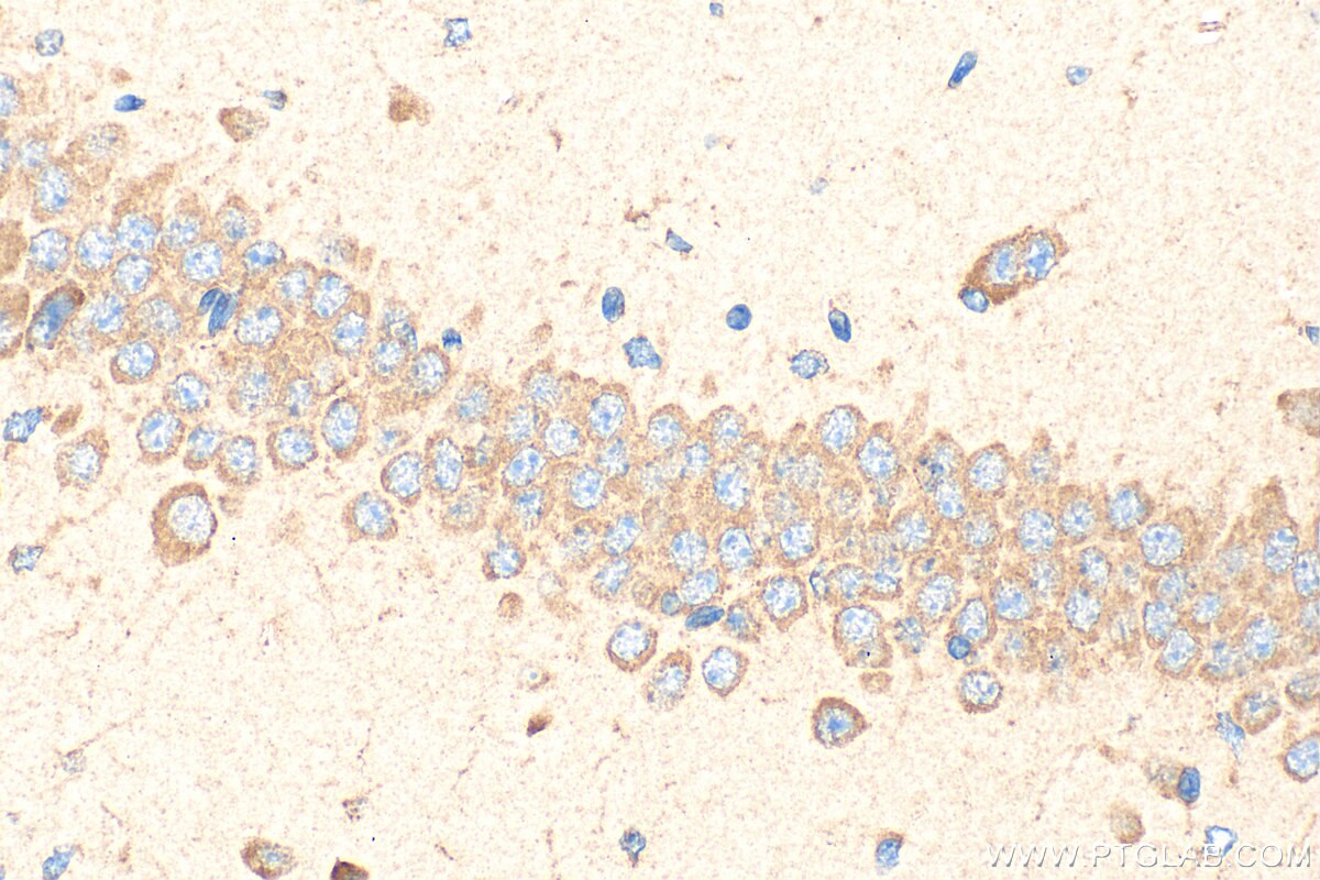 Immunohistochemistry (IHC) staining of mouse brain tissue using SLITRK2 Polyclonal antibody (21508-1-AP)