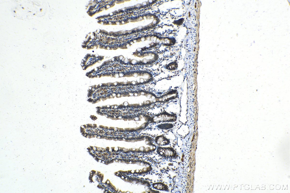 Immunohistochemistry (IHC) staining of rat small intestine tissue using SLITRK3 Polyclonal antibody (21649-1-AP)