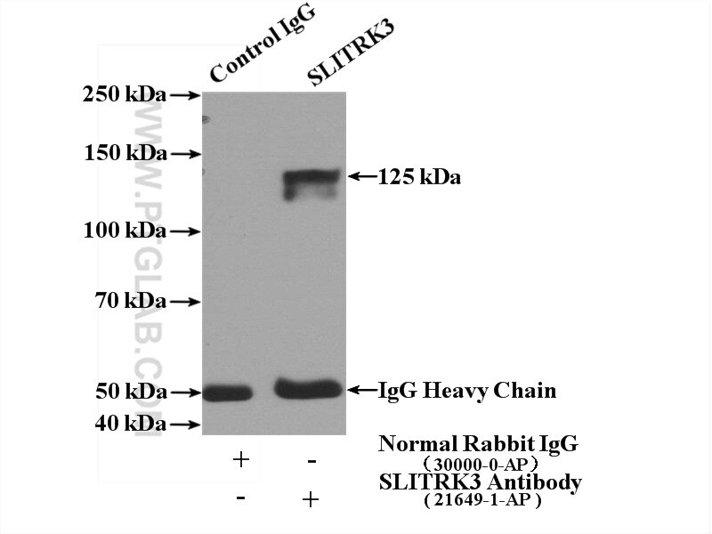 Immunoprecipitation (IP) experiment of mouse brain tissue using SLITRK3 Polyclonal antibody (21649-1-AP)