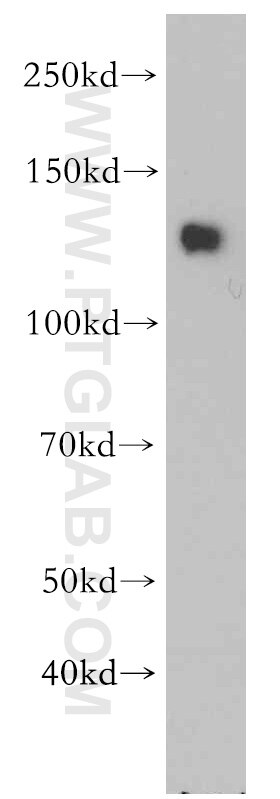 Western Blot (WB) analysis of mouse brain tissue using SLITRK3 Polyclonal antibody (21649-1-AP)