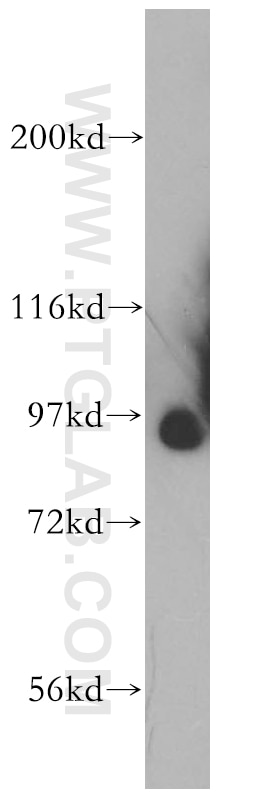 Western Blot (WB) analysis of mouse thymus tissue using SLITRK4 Polyclonal antibody (13835-1-AP)