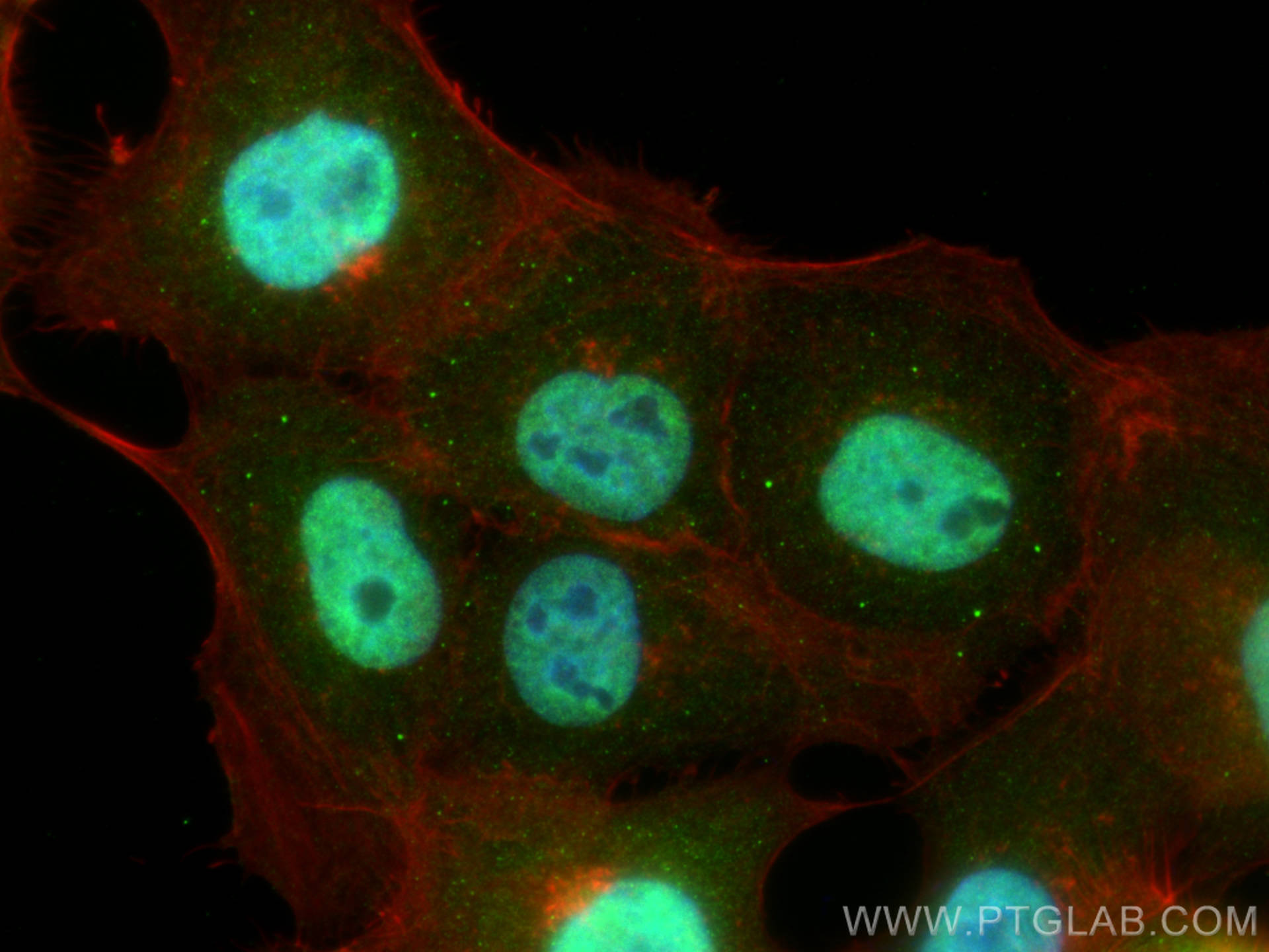 Immunofluorescence (IF) / fluorescent staining of A431 cells using SLITRK5 Polyclonal antibody (21496-1-AP)