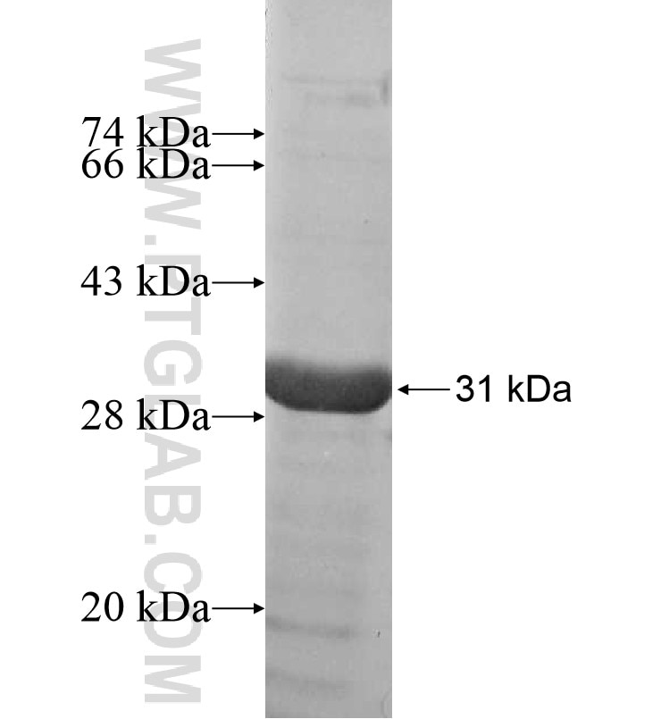 SLITRK5 fusion protein Ag16573 SDS-PAGE