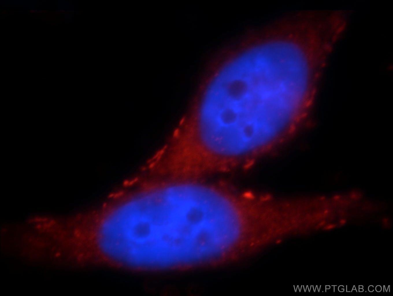 Immunofluorescence (IF) / fluorescent staining of HepG2 cells using SLITRK6 Polyclonal antibody (21150-1-AP)