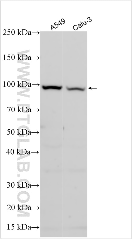 Western Blot (WB) analysis of various lysates using SLITRK6 Polyclonal antibody (21150-1-AP)