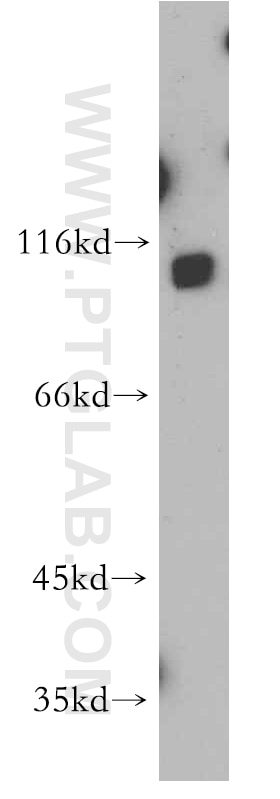 Western Blot (WB) analysis of A549 cells using SLITRK6 Polyclonal antibody (21150-1-AP)