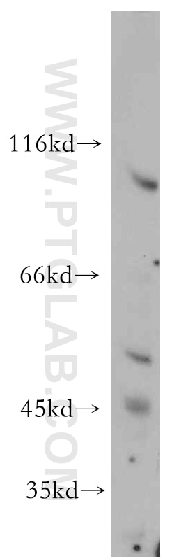 Western Blot (WB) analysis of mouse lung tissue using SLITRK6 Polyclonal antibody (21150-1-AP)