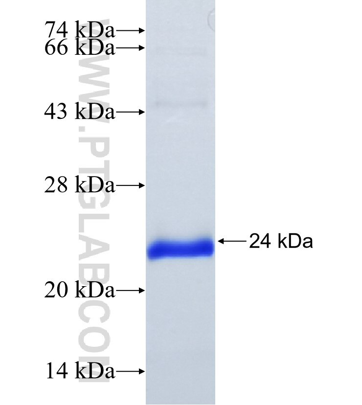 SLITRK6 fusion protein Ag34826 SDS-PAGE