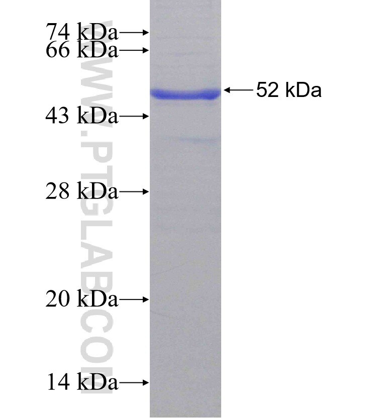 SLITRK6 fusion protein Ag15701 SDS-PAGE