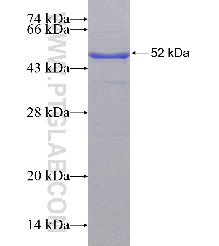 SLITRK6 fusion protein Ag15701 SDS-PAGE