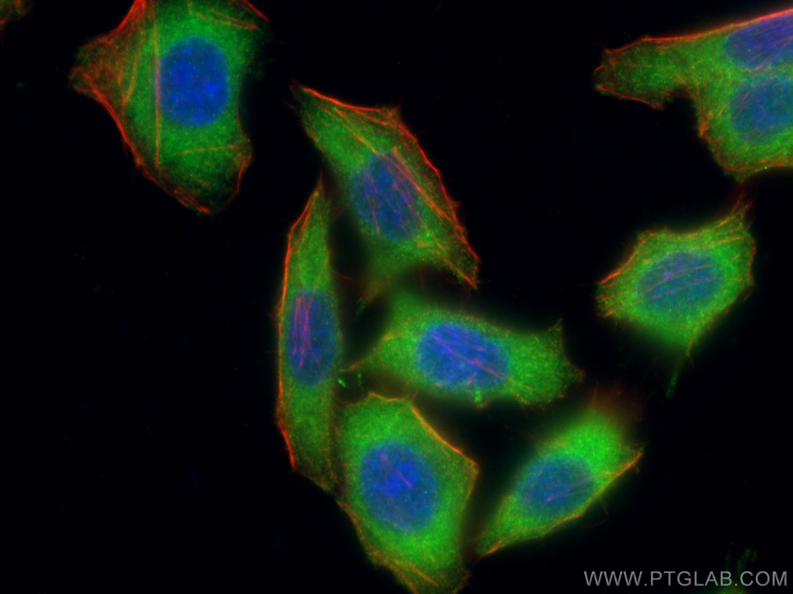 Immunofluorescence (IF) / fluorescent staining of HepG2 cells using SLK Polyclonal antibody (19743-1-AP)