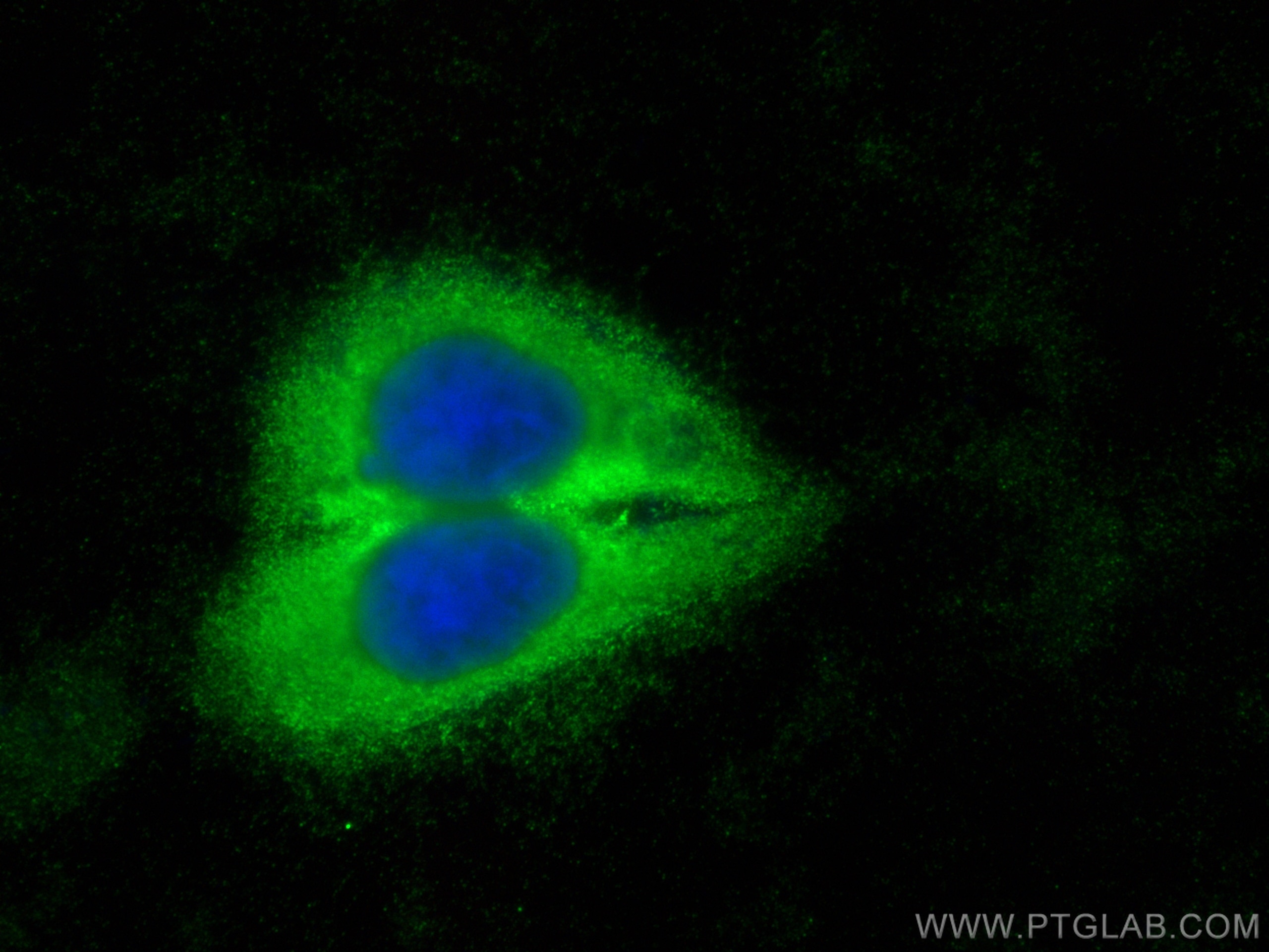 Immunofluorescence (IF) / fluorescent staining of HepG2 cells using SLK Polyclonal antibody (19743-1-AP)