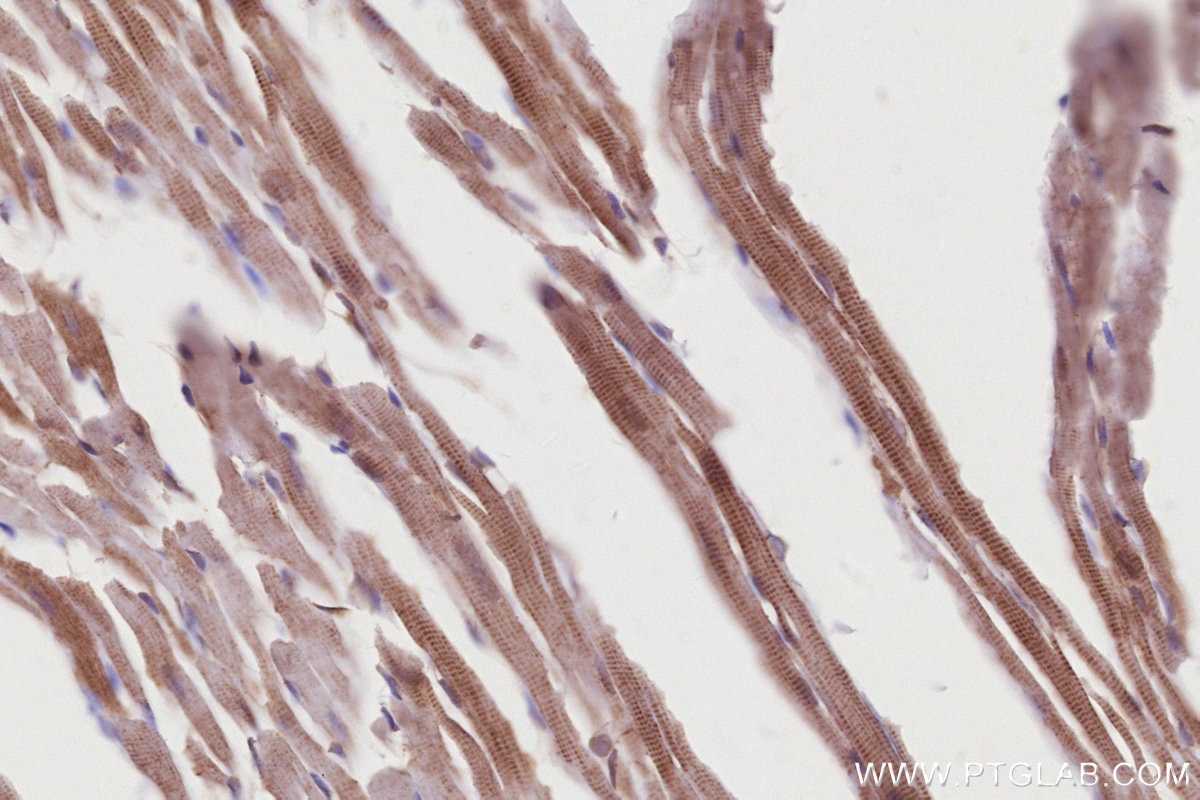 Immunohistochemistry (IHC) staining of mouse heart tissue using SLK Polyclonal antibody (19743-1-AP)