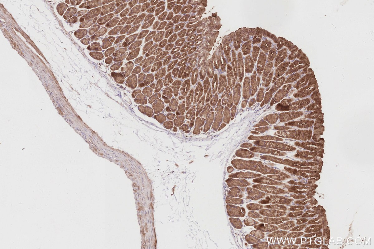 IHC staining of mouse stomach using 19743-1-AP Immunohistochemistry (IHC) staining of mouse stomach tissue using SLK Polyclonal antibody (19743-1-AP)