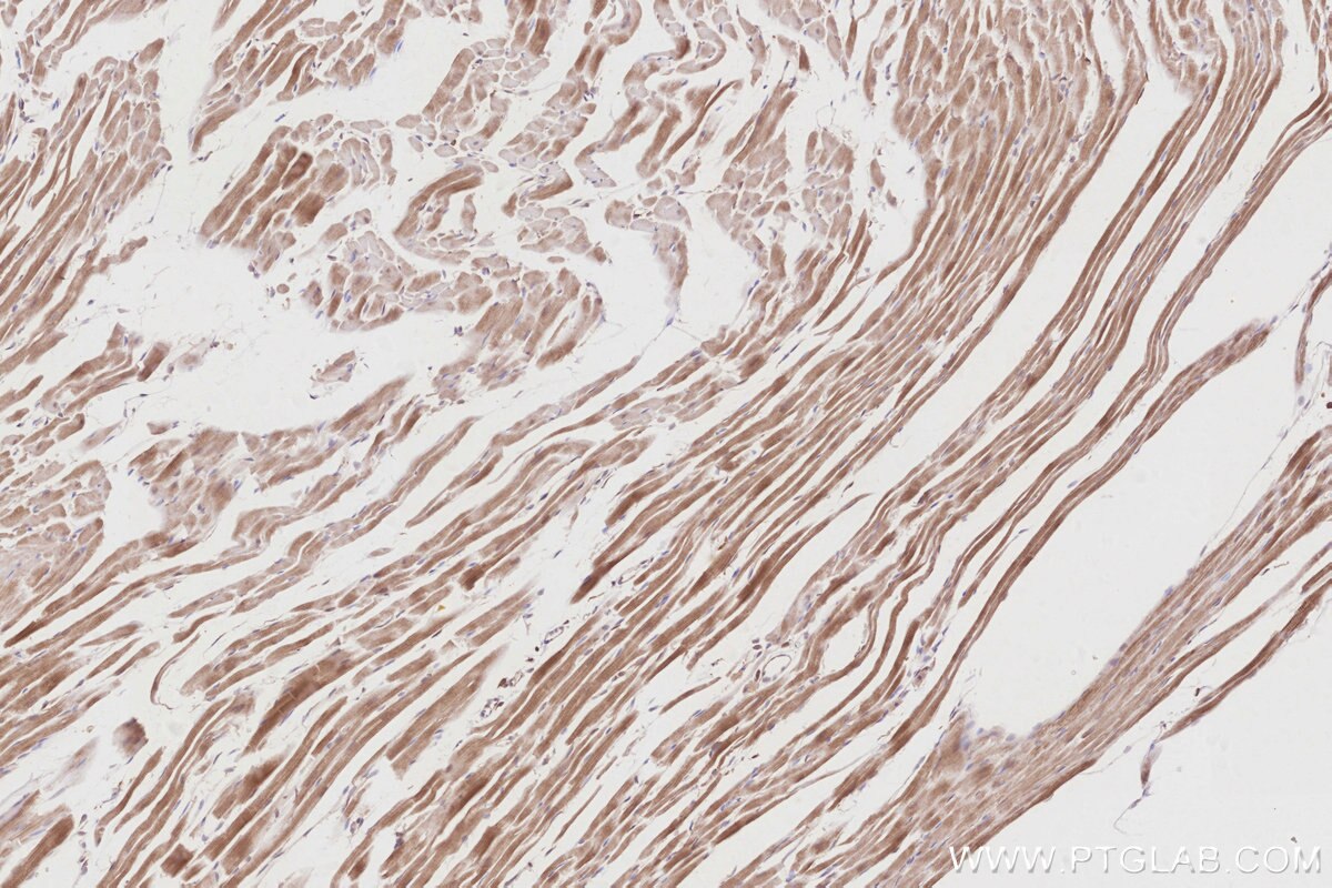 IHC staining of rat heart using 19743-1-AP Immunohistochemistry (IHC) staining of rat heart tissue using SLK Polyclonal antibody (19743-1-AP)