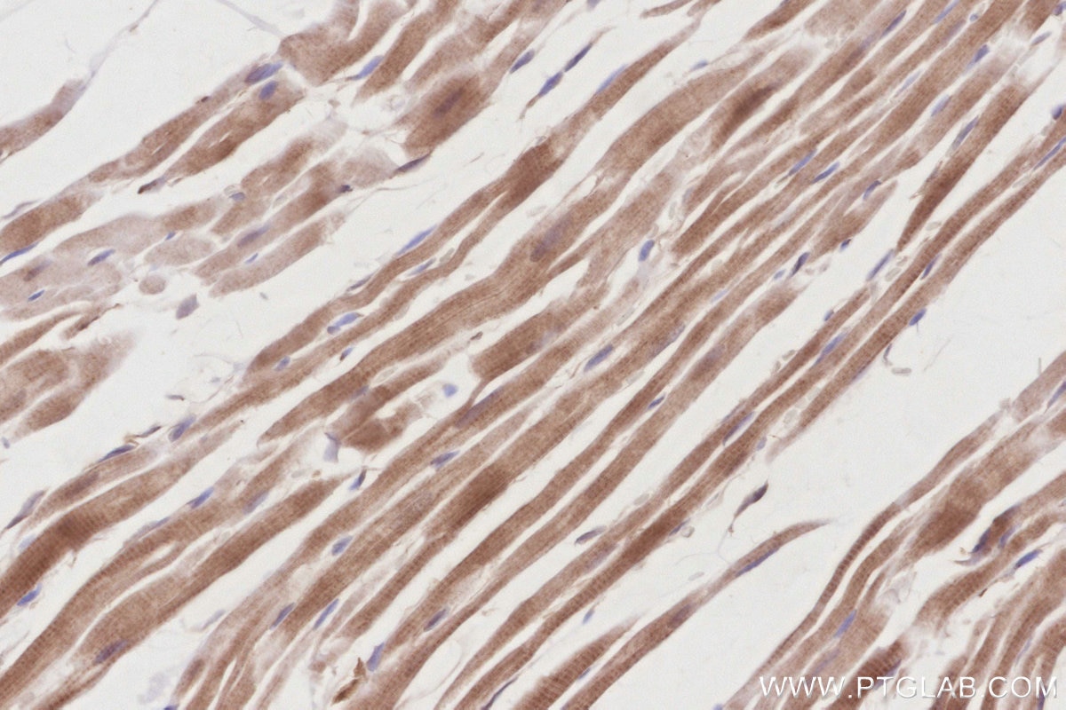 Immunohistochemistry (IHC) staining of rat heart tissue using SLK Polyclonal antibody (19743-1-AP)