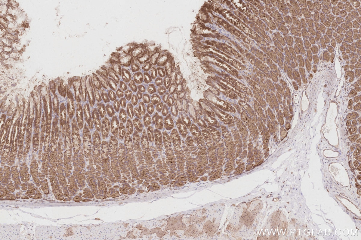 Immunohistochemistry (IHC) staining of rat stomach tissue using SLK Polyclonal antibody (19743-1-AP)