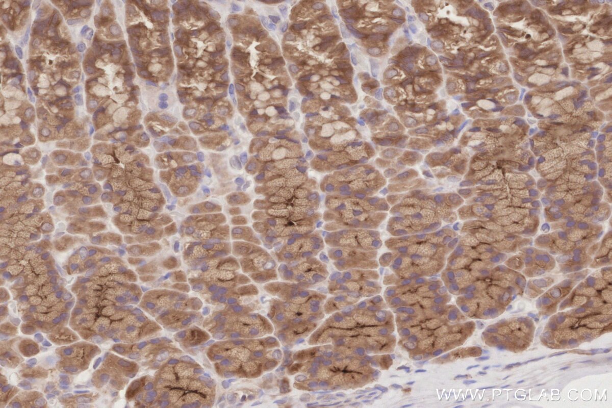 IHC staining of rat stomach using 19743-1-AP Immunohistochemistry (IHC) staining of rat stomach tissue using SLK Polyclonal antibody (19743-1-AP)