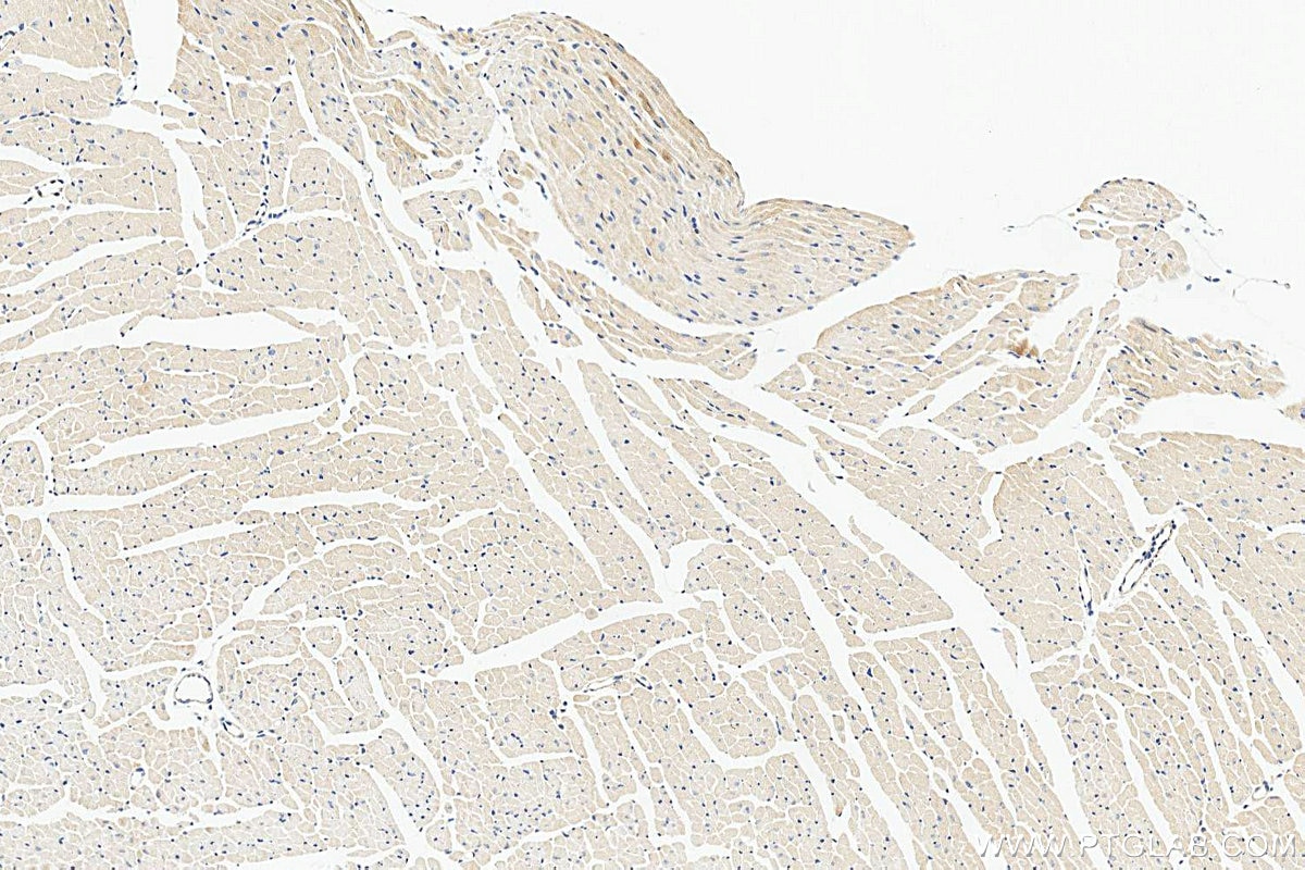 IHC staining of mouse heart using 19743-1-AP Immunohistochemistry (IHC) staining of mouse heart tissue using SLK Polyclonal antibody (19743-1-AP)