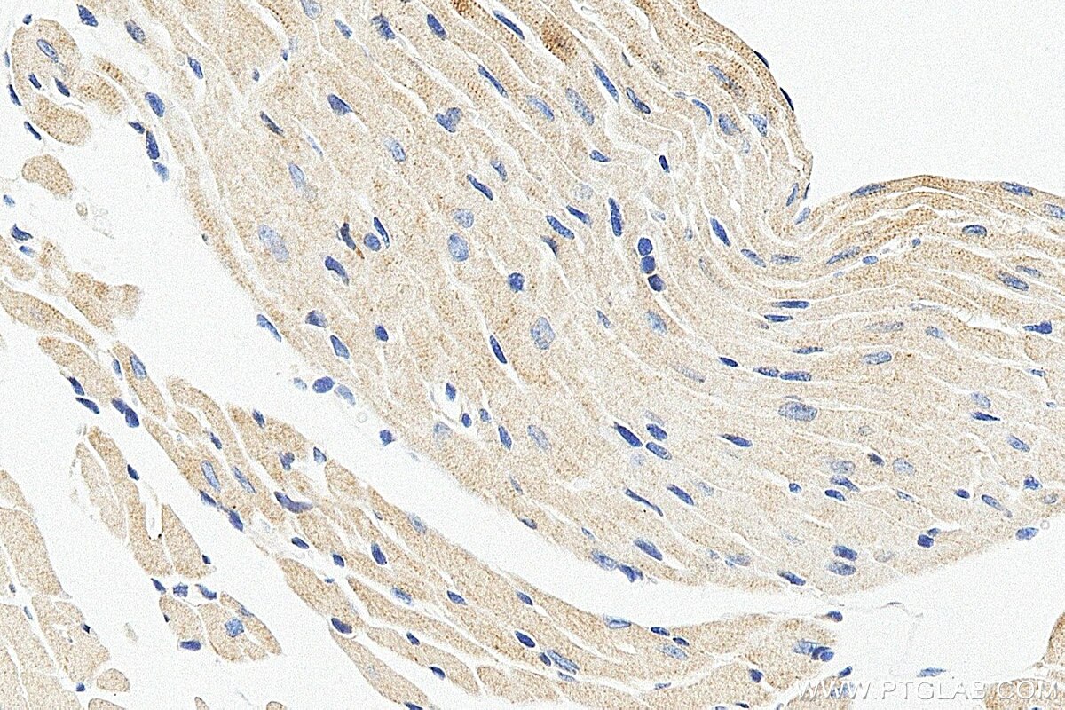 IHC staining of mouse heart using 19743-1-AP Immunohistochemistry (IHC) staining of mouse heart tissue using SLK Polyclonal antibody (19743-1-AP)