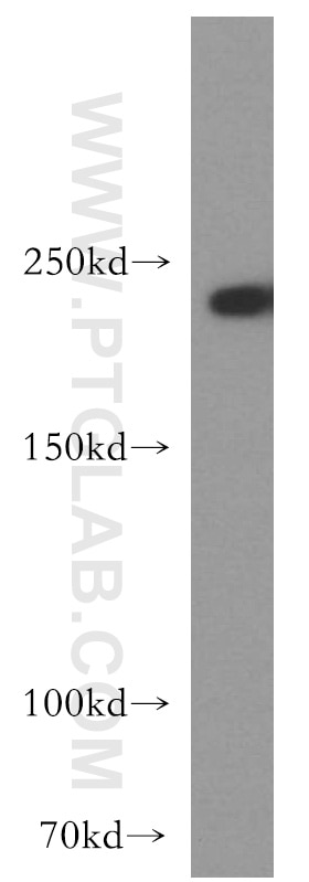 Western Blot (WB) analysis of human brain tissue using SLK Polyclonal antibody (19743-1-AP)