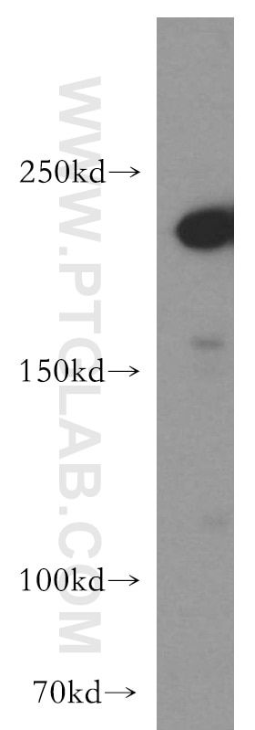 Western Blot (WB) analysis of MCF-7 cells using SLK Polyclonal antibody (19743-1-AP)