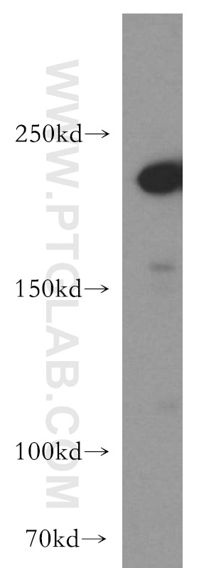 Western Blot (WB) analysis of MCF-7 cells using SLK Polyclonal antibody (19743-1-AP)