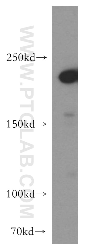 WB analysis of MCF-7 using 19743-1-AP