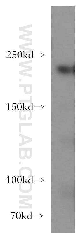 Western Blot (WB) analysis of mouse liver tissue using SLK Polyclonal antibody (19743-1-AP)