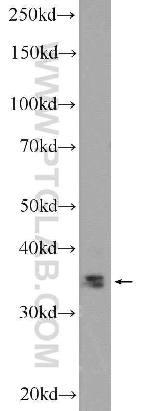 Western Blot (WB) analysis of mouse skeletal muscle tissue using SLMAP Polyclonal antibody (25220-1-AP)