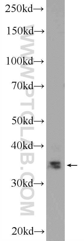 WB analysis of mouse skeletal muscle using 25220-1-AP