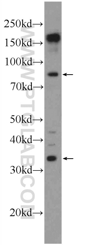 Western Blot (WB) analysis of A431 cells using SLMAP Polyclonal antibody (25220-1-AP)