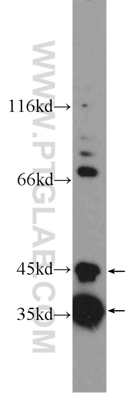 Western Blot (WB) analysis of mouse heart tissue using SLMAP Polyclonal antibody (25220-1-AP)