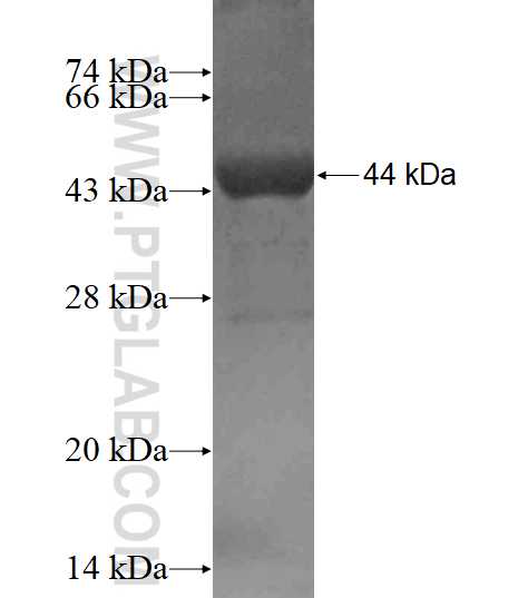 SLMAP fusion protein Ag18162 SDS-PAGE