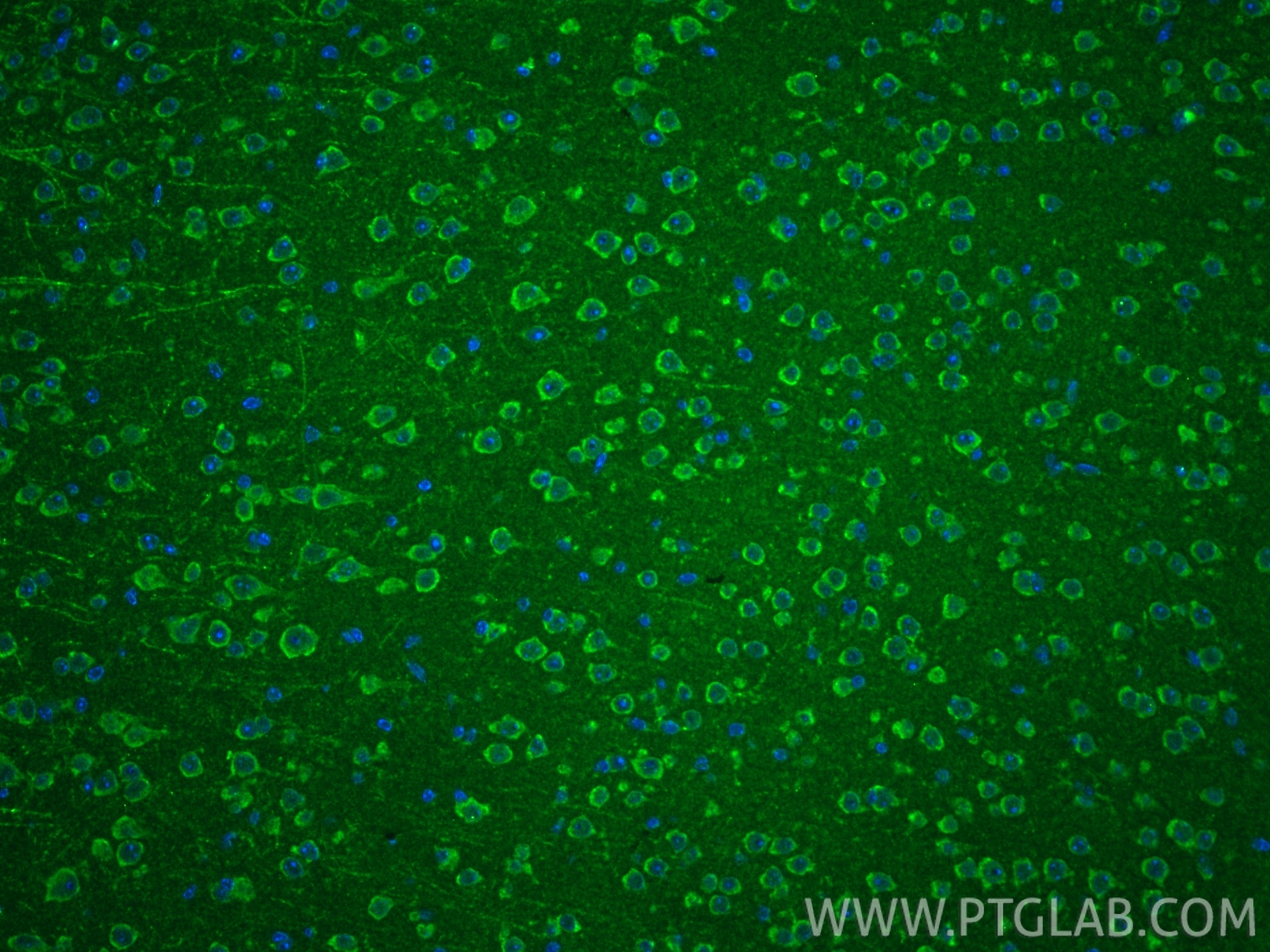 IF Staining of mouse brain using 25065-1-AP Immunofluorescence (IF) / fluorescent staining of mouse brain tissue using PRELID3A Polyclonal antibody (25065-1-AP)