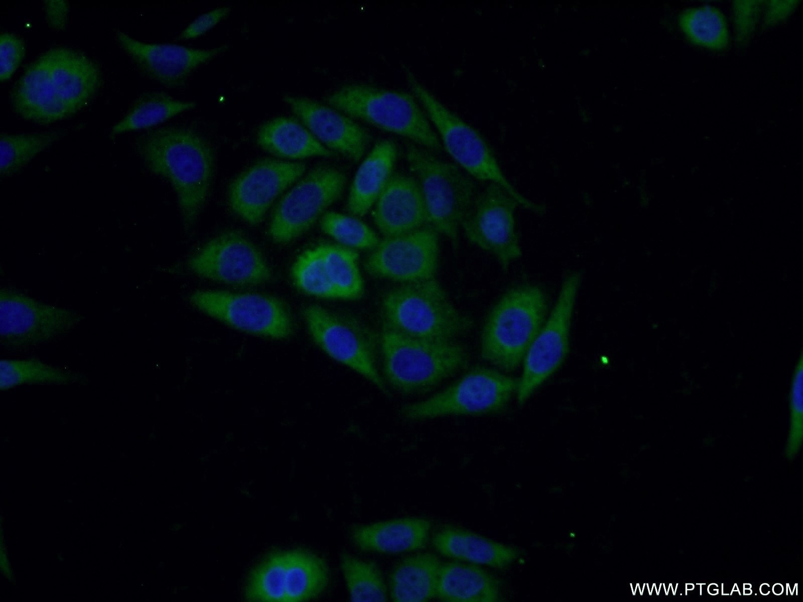 Immunofluorescence (IF) / fluorescent staining of PC-3 cells using SLN Polyclonal antibody (18395-1-AP)