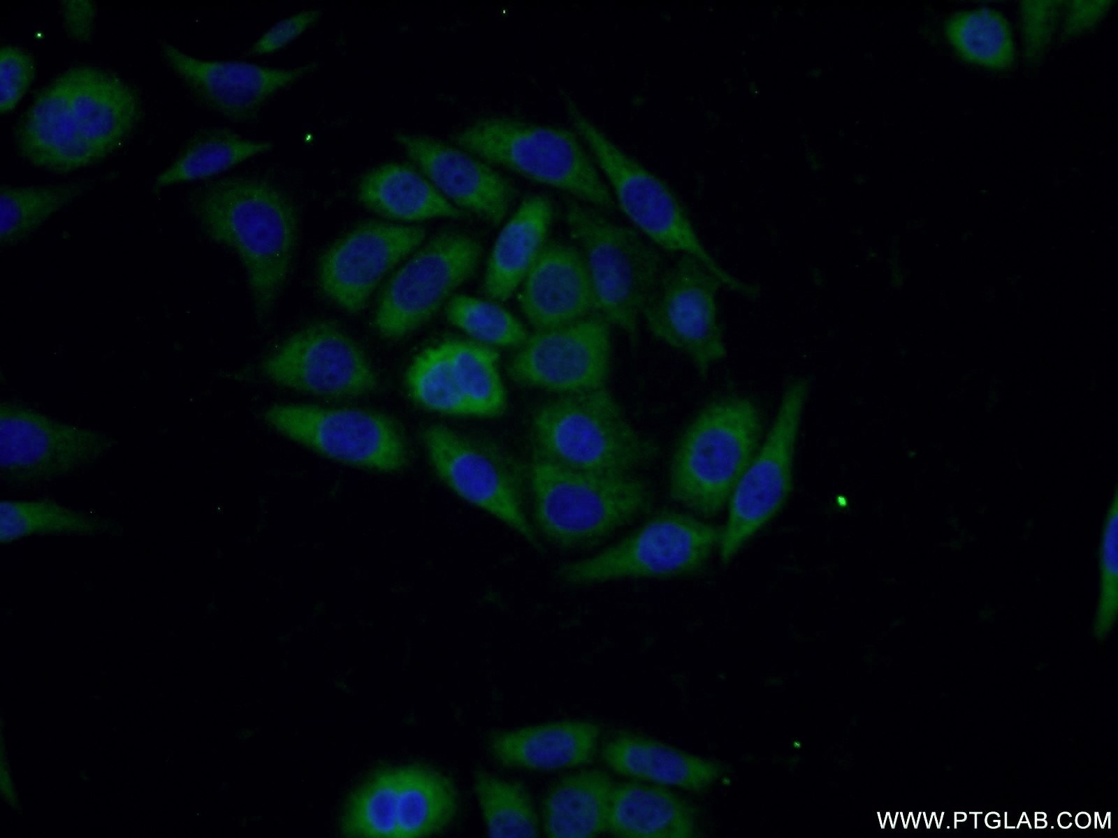 IF Staining of PC-3 using 18395-1-AP