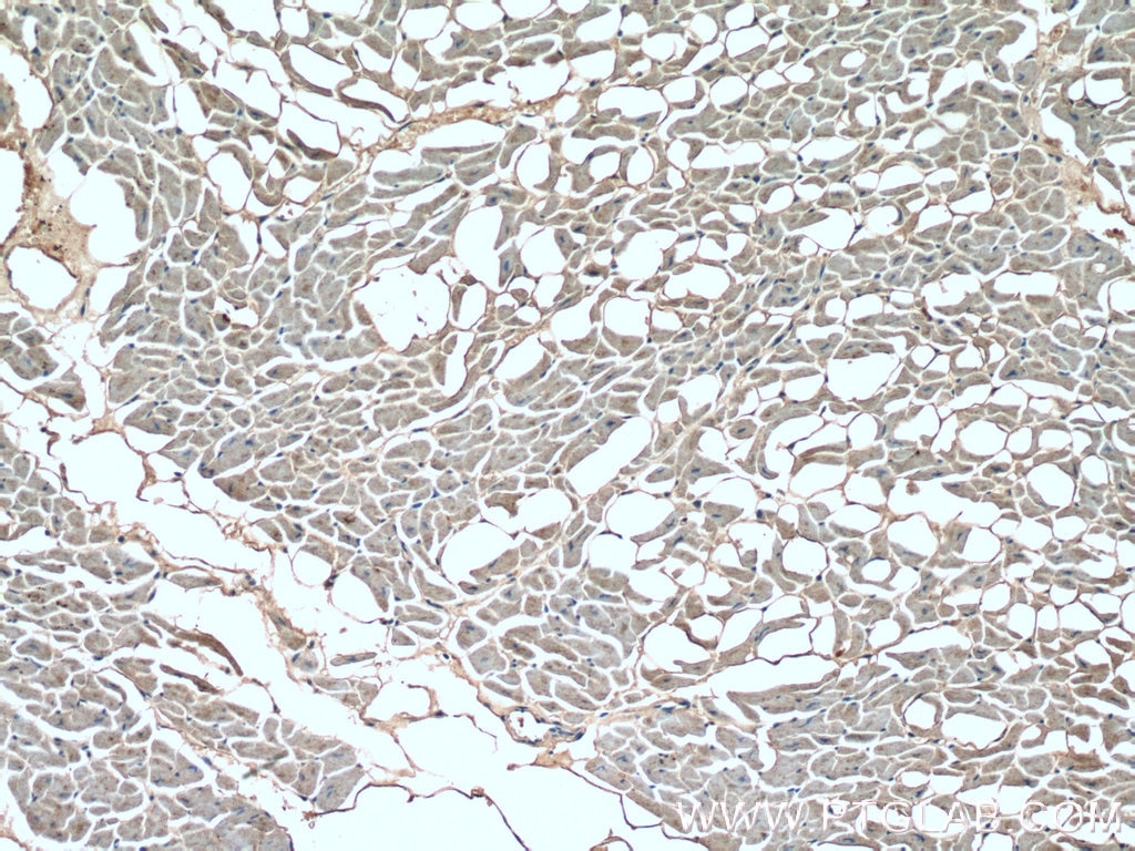 IHC staining of human heart using 18395-1-AP