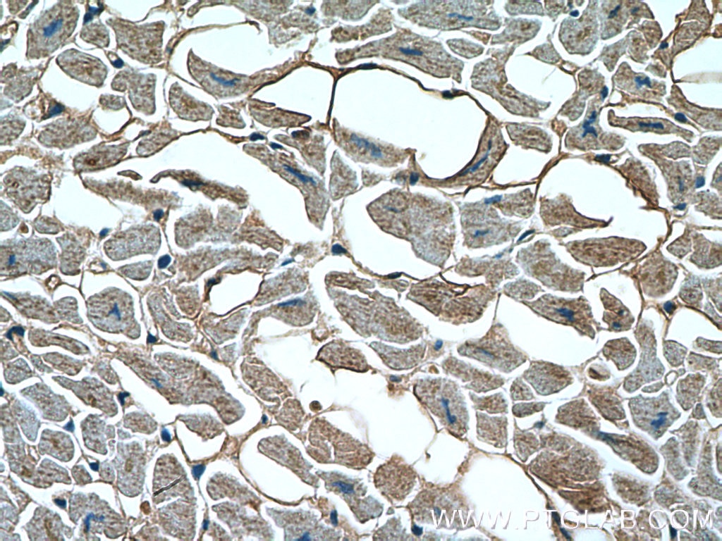 Immunohistochemistry (IHC) staining of human heart tissue using SLN Polyclonal antibody (18395-1-AP)