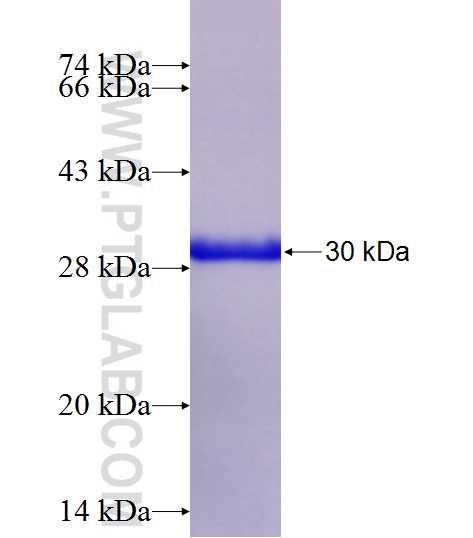 SLN fusion protein Ag13176 SDS-PAGE