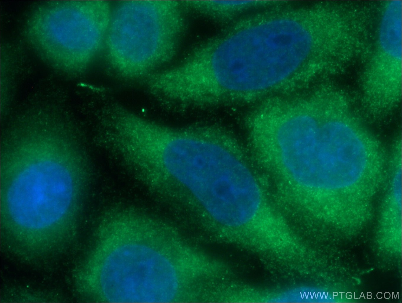 Immunofluorescence (IF) / fluorescent staining of HeLa cells using SLP76 Monoclonal antibody (66465-1-Ig)