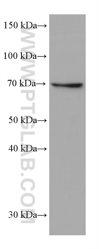 Western Blot (WB) analysis of K-562 cells using SLP76 Monoclonal antibody (66465-1-Ig)