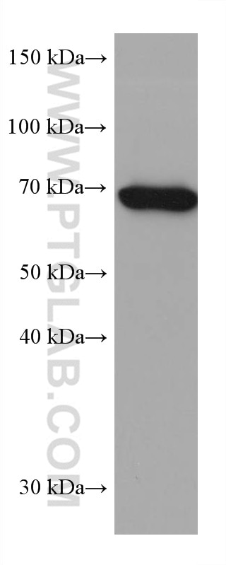Western Blot (WB) analysis of Jurkat cells using SLP76 Monoclonal antibody (66465-1-Ig)