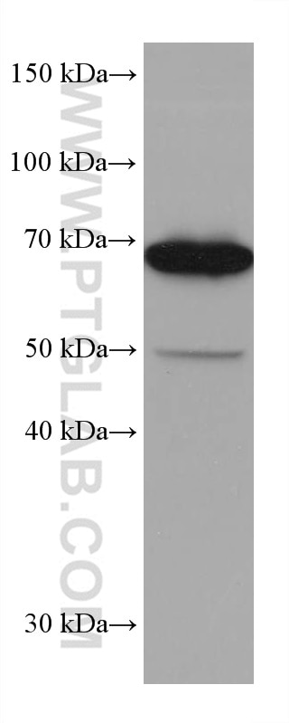 Western Blot (WB) analysis of MOLT-4 cells using SLP76 Monoclonal antibody (66465-1-Ig)