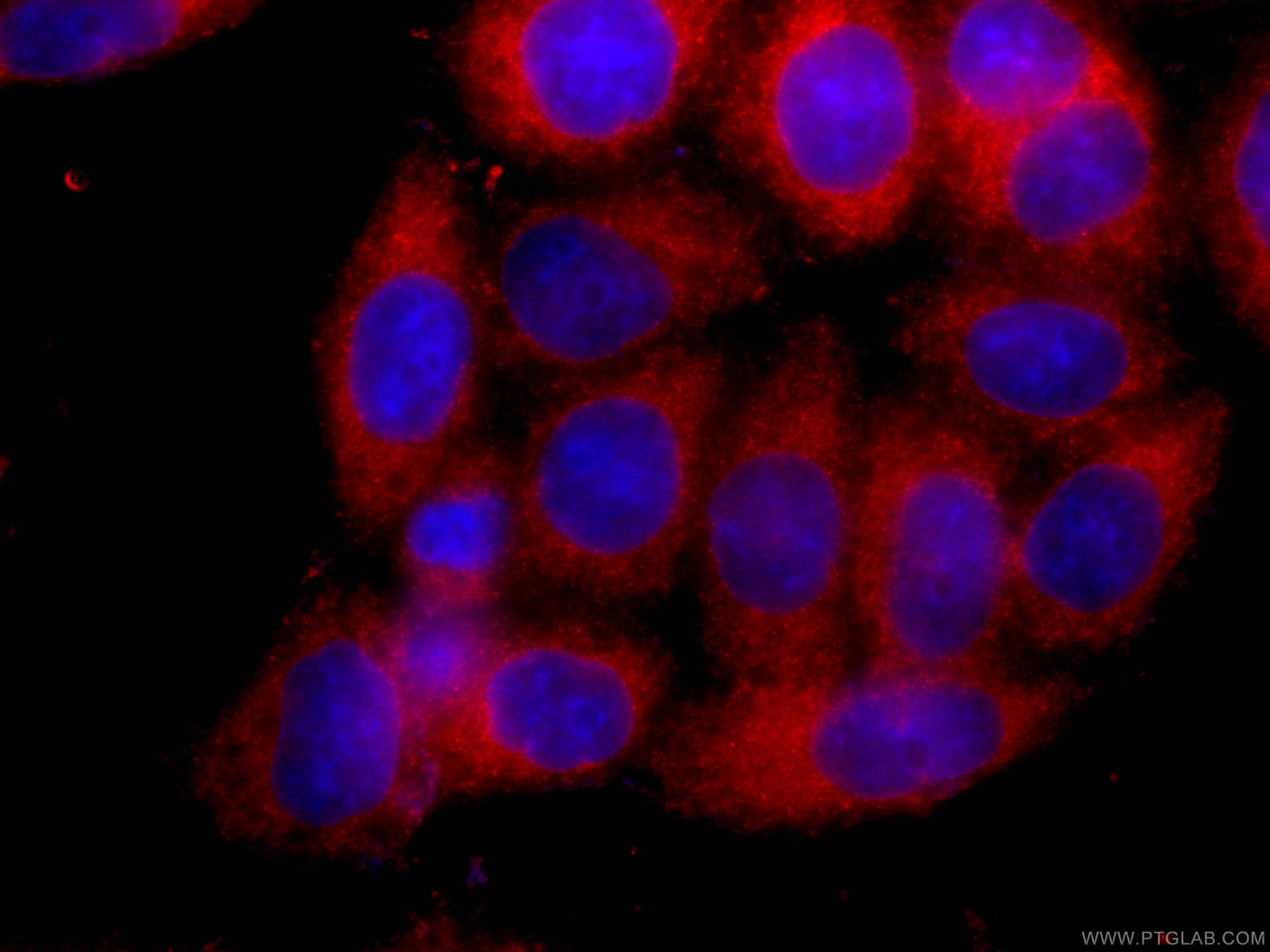 Immunofluorescence (IF) / fluorescent staining of HeLa cells using CoraLite®594-conjugated SLP76 Monoclonal antibody (CL594-66465)